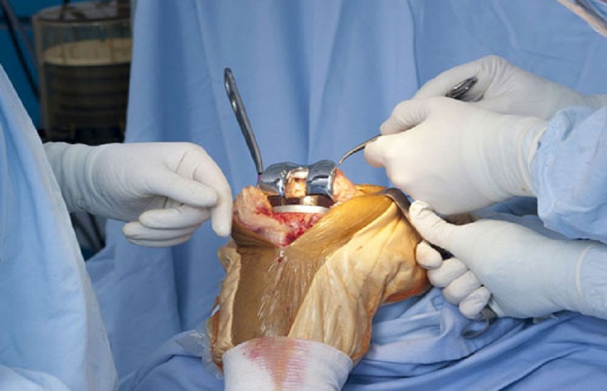 Professional Ideas for Accelerated Restoration Following Joint Alternative Surgical procedure